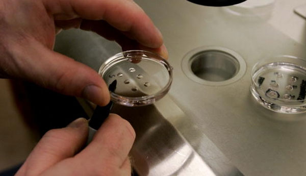 விந்தணுக்களை உற்பத்தி செய்யக்கூடிய இனவிருத்தி உறுப்பு கண்டுபிடிப்பு விந்தணுக்களை உற்பத்தி செய்யக்கூடிய இனவிருத்தி உறுப்பு கண்டுபிடிப்பு