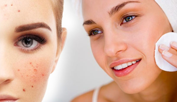 பரு வந்த இடத்தில் தழும்பு மட்டும் போகவில்லையா??