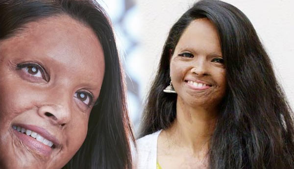 அசிட் வீச்சால் பாதிக்கப்பட்ட பெண்ணாக பிரபல நடிகை…